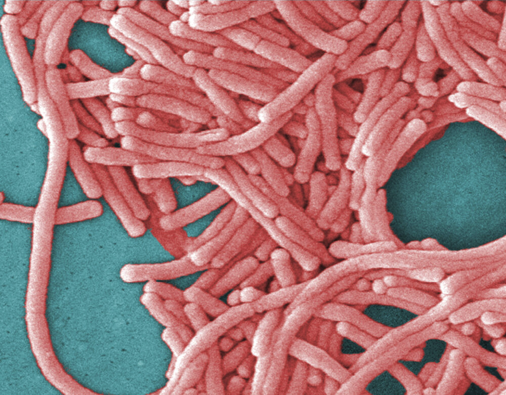 Legionella bacteria